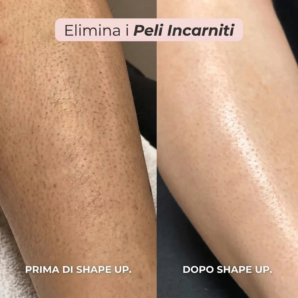 Rasoio 2 in 1 per Bikini e Corpo Shape Up™