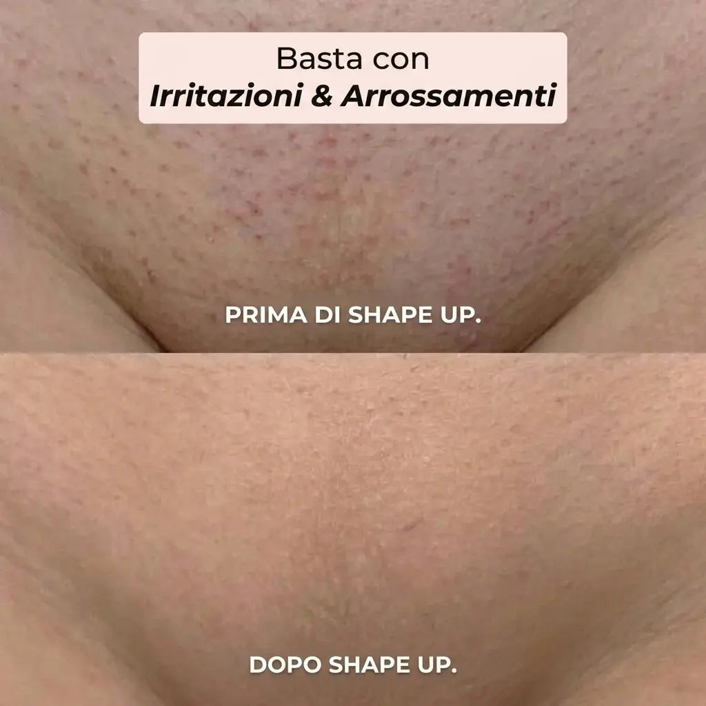 Rasoio 2 in 1 per Bikini e Corpo Shape Up™